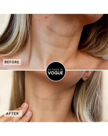 Sensse LED Neck Mask